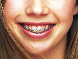 orthodontie ostéopathie dent hadrien corjon ostéopathe guilvinec finistère 29